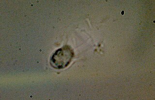 <span class="mw-page-title-main">Acanthoecida</span> Order of choanoflagellates