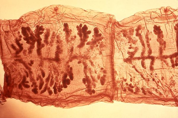 Two proglottids of Taenia solium. This species has 7 to 13 branches of the uterus on each side (above and below in this micrograph).