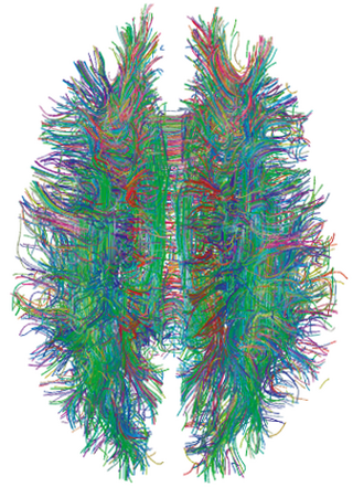 <span class="mw-page-title-main">Nerve tract</span> Bundle of nerve fibers (axons) connecting nuclei of the central nervous system