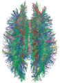 May 22: White matter connections illustrated with MRI tractography,