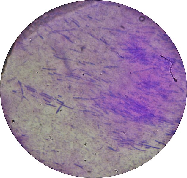 File:Bacillus thuringiensis-S.jpg