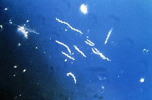 Borrelia burgdorferi powiększona 400 razy.