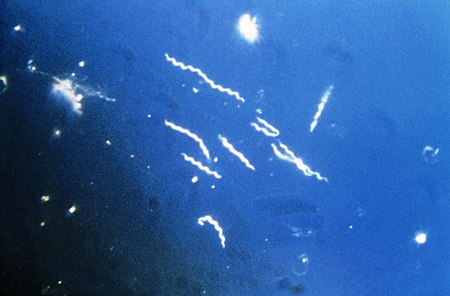 Borrelia_burgdorferi