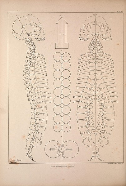 File:Comparative osteology (Plate 33) (9240342012).jpg