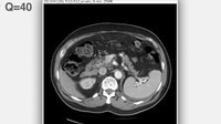 File:Continuously varied JPEG compression for an abdominal CT scan - 1471-2342-12-24-S1.ogv