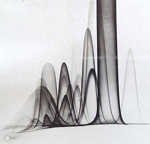 CrossedimmunoelectrophoresisTCBH.jpg