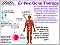 Schema della terapia genica ex vivo