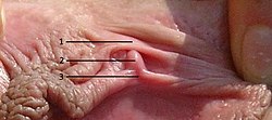 External clitoris.jpg