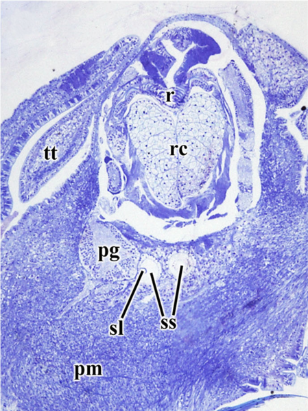 File:Gigantopelta chessoia statocysts.png