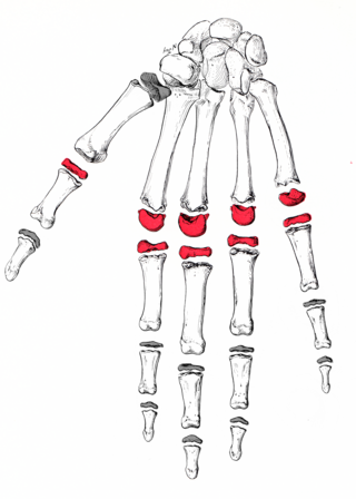 <span class="mw-page-title-main">Metacarpophalangeal joint</span>