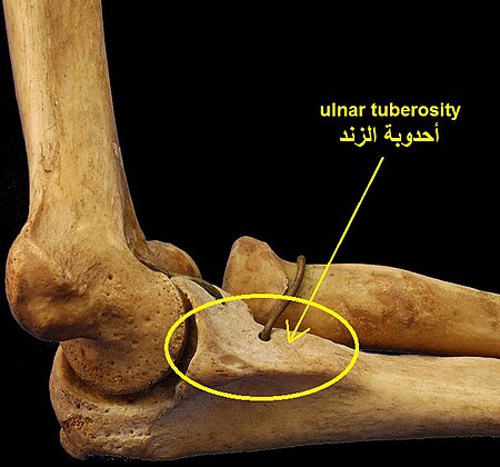 MedialHumerusRadiusUlnaArticulated Arabic YM.jpg