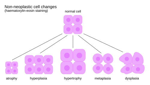 Non-neoplastic cell changes