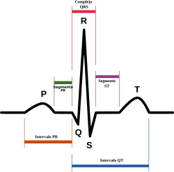 SinusRhythmLabels-es.svg