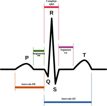 File:SinusRhythmLabels-es.svg