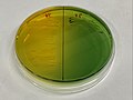 TCBS agar plate of Vibrio Cholerae and vibrio parahaemolyticus.jpg