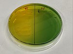 Thumbnail for Thiosulfate–citrate–bile salts–sucrose agar