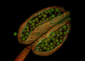 Anthère d'Arabette des dames (Arabidopsis thaliana) avec ses grains de pollen révélés par la micrographie par fluorescence. (définition réelle 6 600 × 4 800)