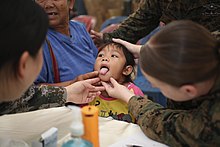 Ziraphinya Somari, center, sticks her tongue out for multinational medical professionals during a cooperative health engagement in Sukhothai, Thailand, 13 February 2014, during exercise Cobra Gold 2014. 140213-M-LT992-422 (12526334154).jpg