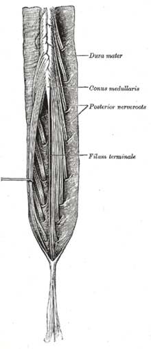 Thumbnail for Cauda equina syndrome