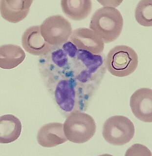 Critical green inclusion Abnormal white blood cell inclusion