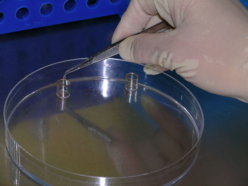 File:Human cell-line colony being cloned in vitro through use of cloning rings.jpg