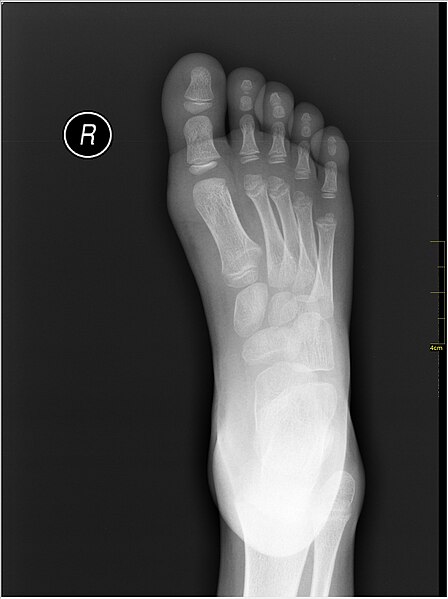 File:Medical X-Ray imaging UDK07 nevit.jpg