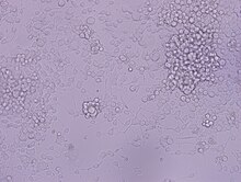 PC 12 cells, having been cultured about two days. Pc12may28-MAY-28-2011.19.26.39-4.jpg