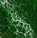 Vignette pour Microscopie de seconde harmonique