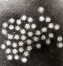 Transmission electron micrograph of Sapporo viruses