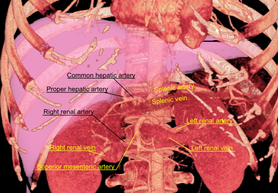 File:3D rendered CT of abdominal aortic branches and kidneys.png