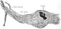 Longitudinal section of 12th dorsal ganglion. Death 103 days after eruption first appeared.