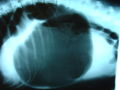 Thumbnail for Gastric dilatation volvulus