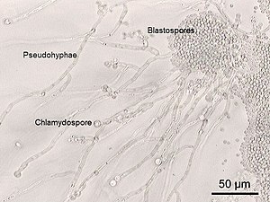 Candida albicans, pseudohyphae (left, with blastoconidia and chlamydospores) and yeast-like cells (right)