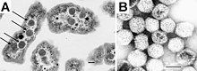 Carboxysomes EM.jpg