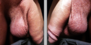 Thumbnail for File:Flaccid uncircumcised penis.png