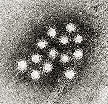 Electron micrograph of "Hepatovirus A" virions