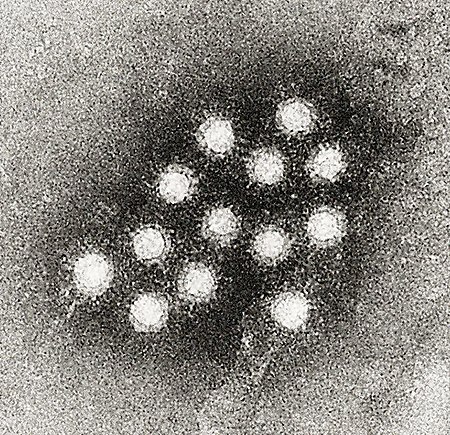 Fail:Hepatitis A virus 02.jpg