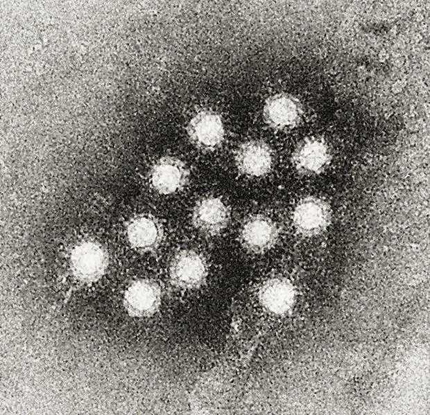 File:Hepatitis A virus 02.jpg