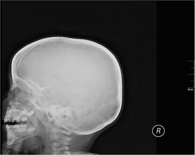 File:Medical X-Ray imaging RRZ07 nevit.jpg