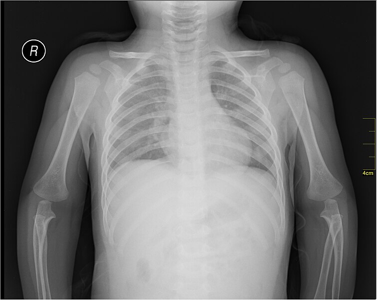 File:Medical X-Ray imaging SCJ07 nevit.jpg