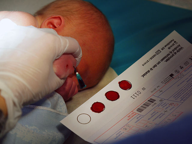 Shows blood sample being taken from a baby to perform new born screening test.