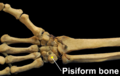 RightHumanAnteriorDistalRadiusUlnaCarpals - Pisiform bone.png