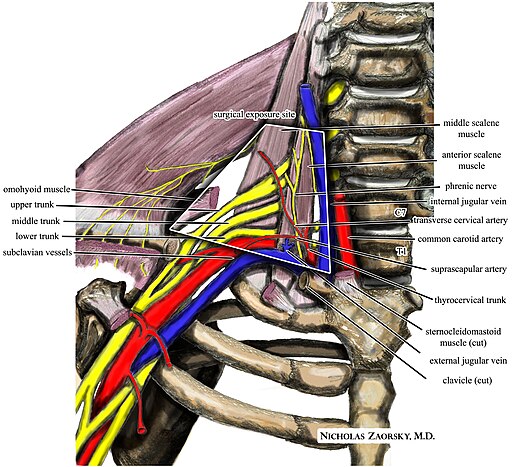 Wikipedia medical illustration thoracic outlet syndrome brachial plexus anatomy with labels