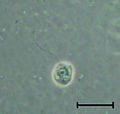 Codosiga sp. cell transforming into a cyst