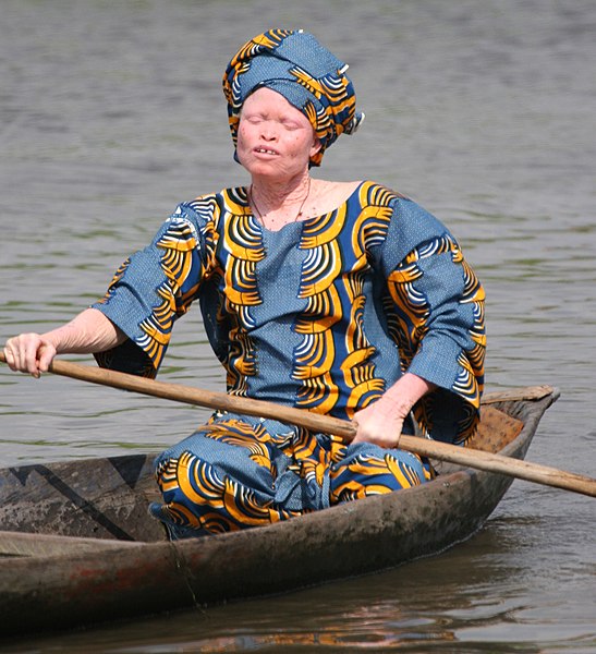 File:Albino woman in canoe, Benin (cropped).jpg