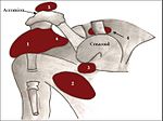 Thumbnail for Subacromial bursa