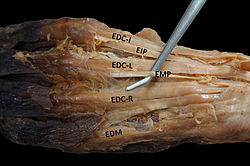 Extensor digiti medii, prosinec 2014.jpg