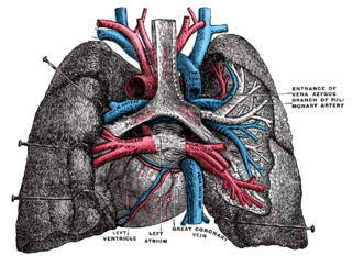 <span class="mw-page-title-main">Pulmonary vein stenosis</span> Medical condition