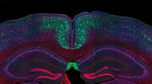 Вигляд мишачого гіпокампу, забарвленого різними флуоресцентними білками, що показує численну щільність ядер і нейронів
