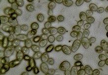 Yeast and bacteria in kombucha magnified 400 times Kombuchacultsm.jpg